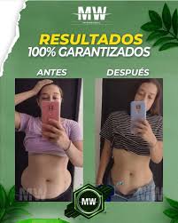 FIBRA MG